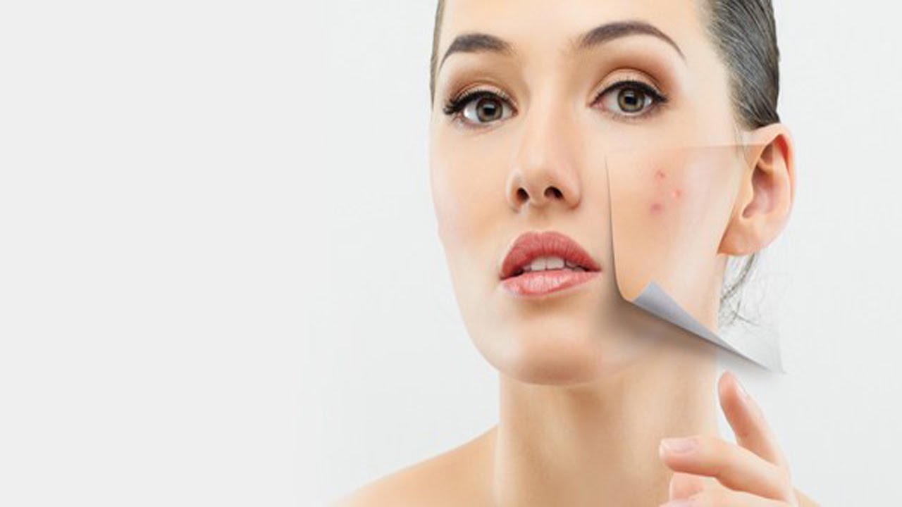 How To Remove Black Spots On Face Home Remedies How To Remove Black Spots On Face Home Remedies