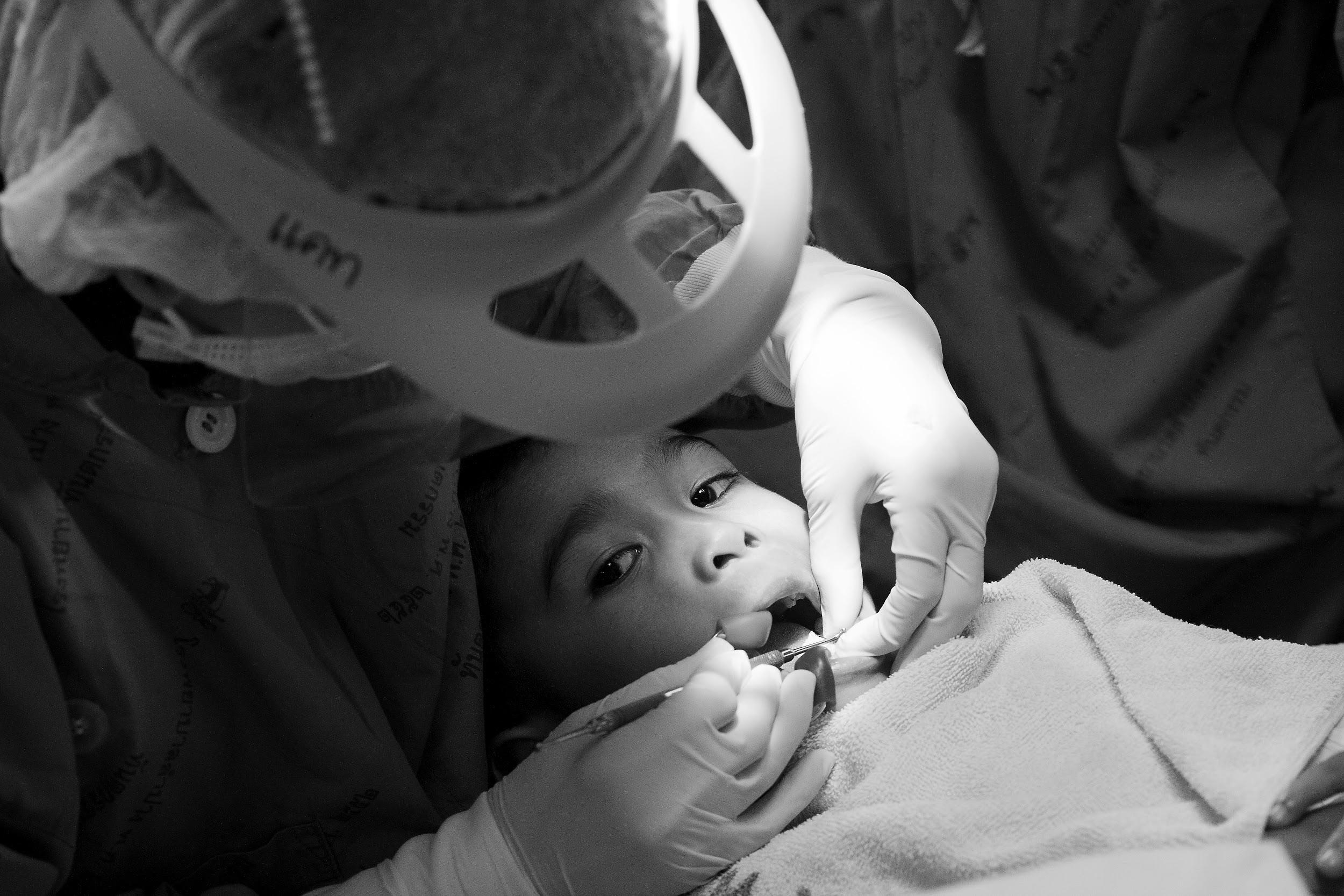 Tooth Whitening Treatment