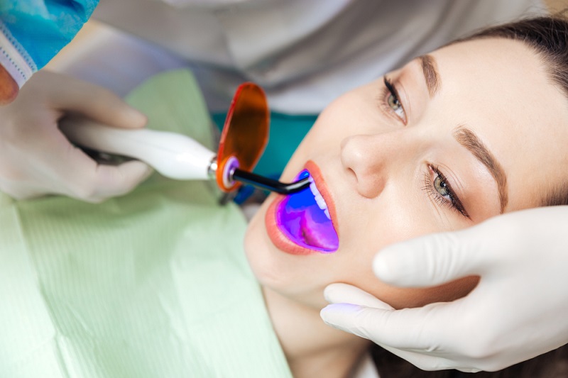 teeth bleaching